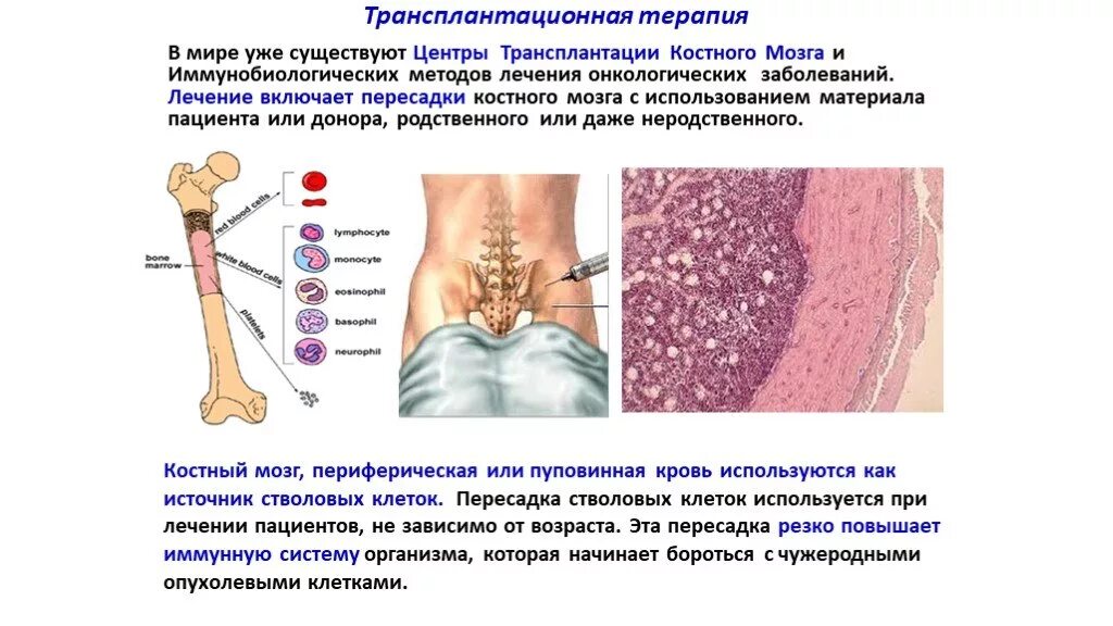 Трепанобиопсия подвздошной. Физиологические основы пересадки костного мозга.. Патологии костного мозга. ТКМ трансплантация костного мозга. Трепанобиопсия костного мозга.