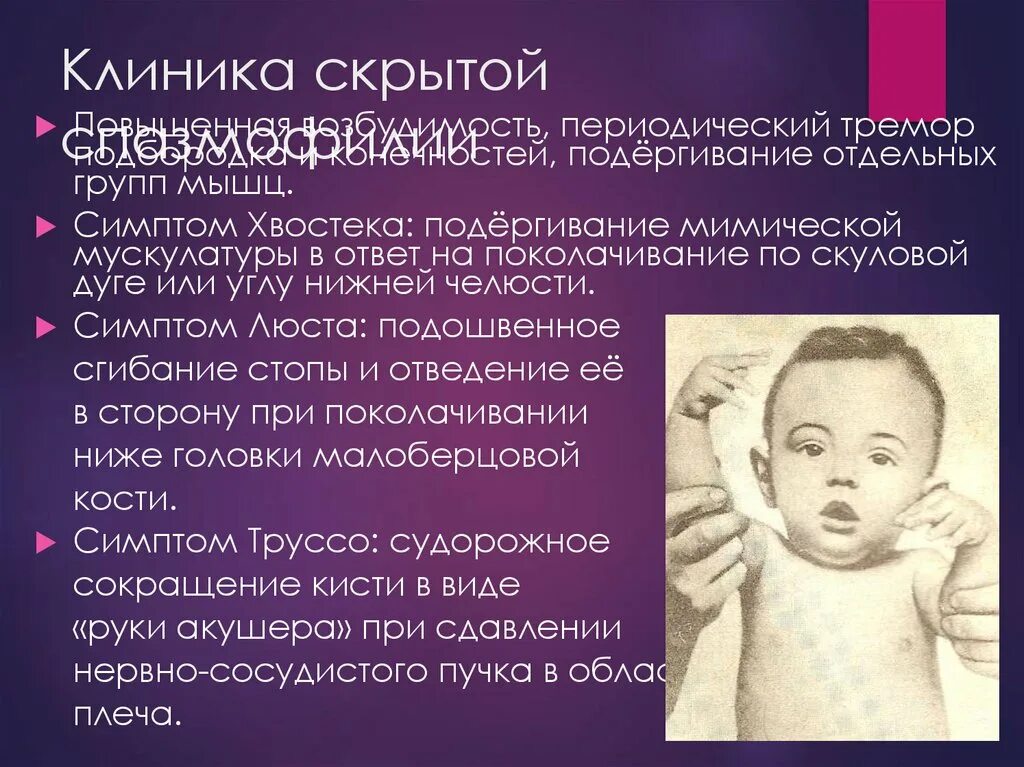 Спазмофилия это