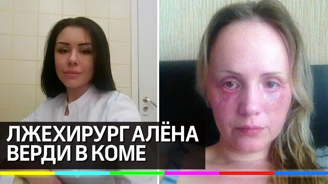 Развод боль предательства верди. Доктор Франкенштейн Алена Верди. Пластический хирург Краснодар Алена Верди. Лжехирург Алена Верди.