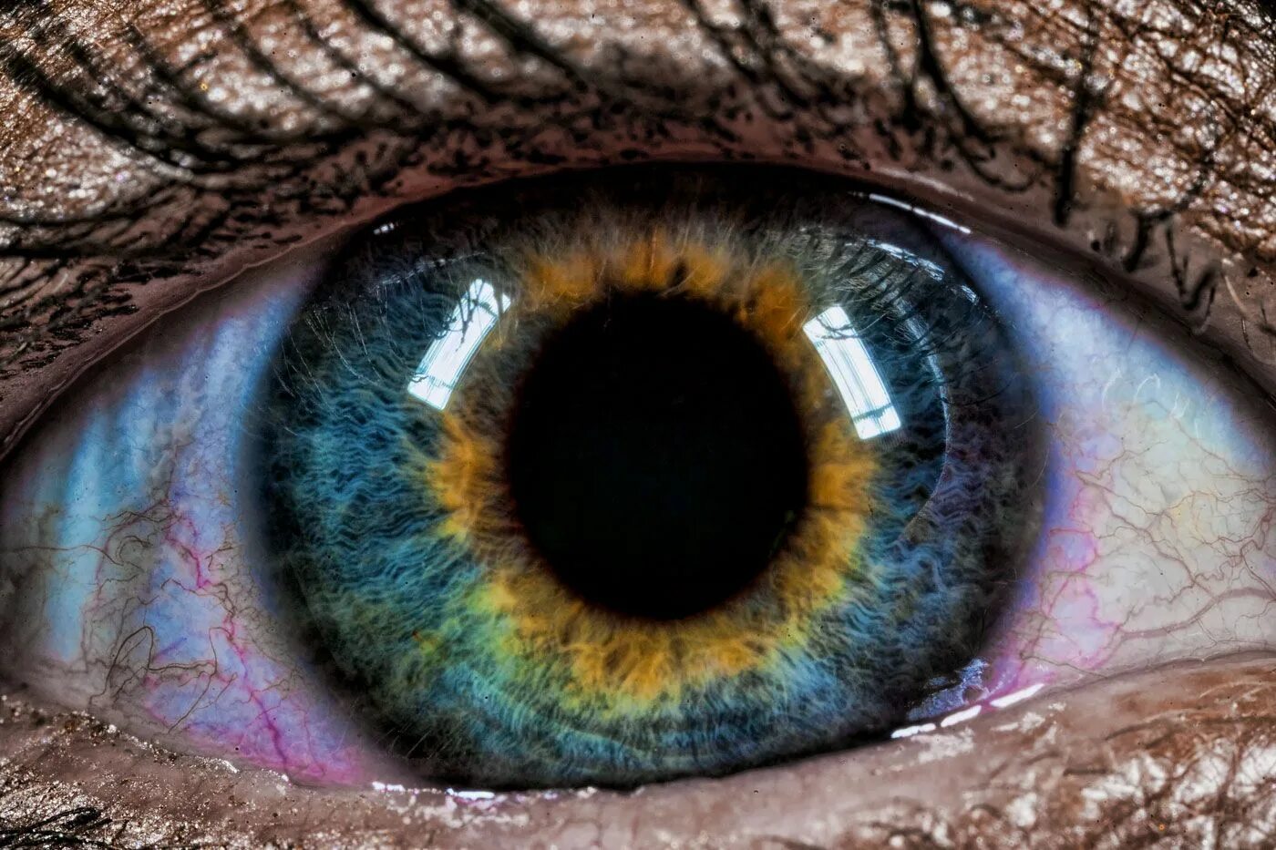 Металлозная гетерохромия. Гетерохромия центральной Радужки. Гетерохромия Радужки глаз. Центральная гетерохромия радужной оболочки глаза. Different eye