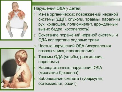Почему возникает дцп