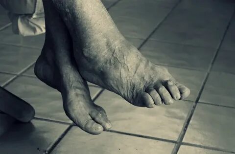Legs old