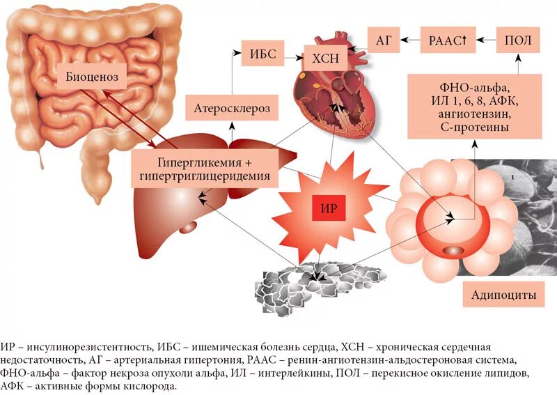 Ожирение и атеросклероз