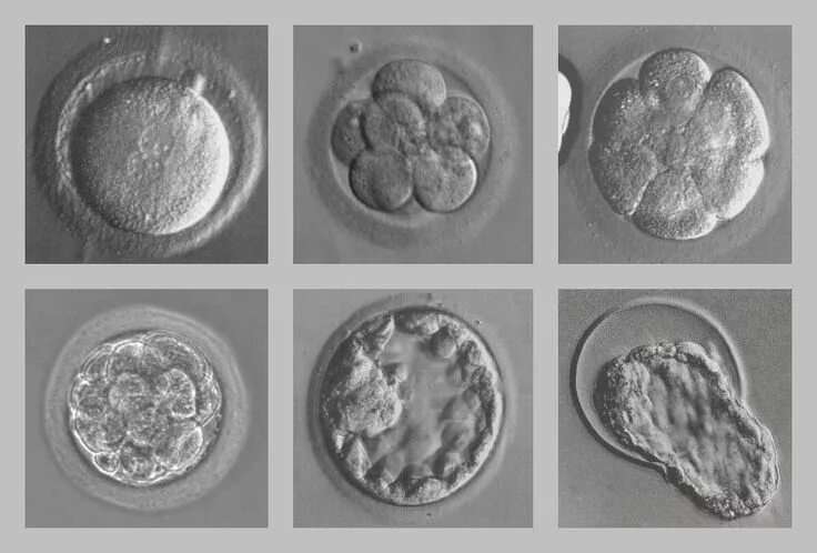 timeline of conception/implantation picture - VERY cool in 2024 Reproductive sys