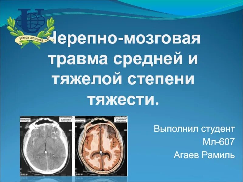 Черепно-мозговая травма. Тяжелая черепно-мозговая травма. Степени черепно-мозговой травмы. Черепно-мозговая травма средней тяжести. Тяжелые травмы головного мозга