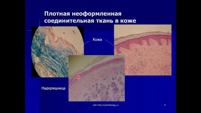 Рыхлая плотная неоформленная соединительная ткань. Плотная неоформленная соединительная ткань функции. плотная неоформленная соединительная ткань кожи пальца человека. специальные ткани гистология. специализированная ткань гистология.