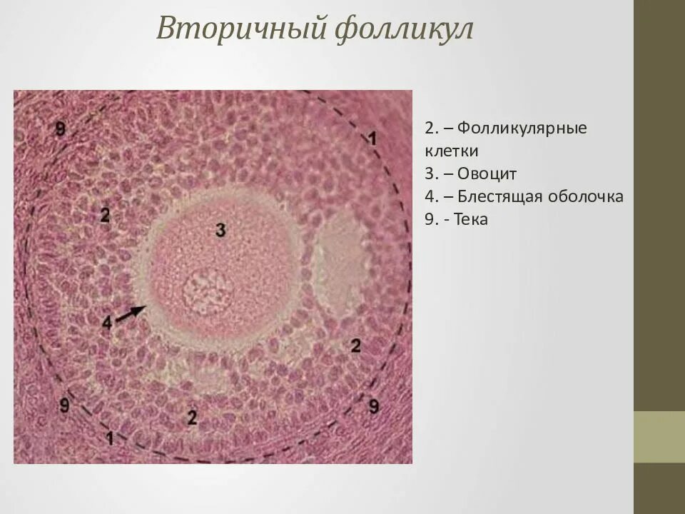 Типы фолликулов. Третичный фолликул. Вторичный фолликул. ТЕКА фолликула. Три фолликула