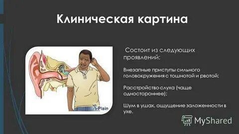 Головокружение шум в ушах при нормальном давлении