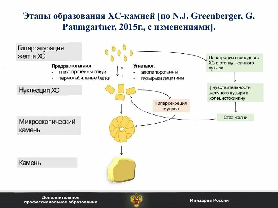 Камень холестерина. Схема патогенеза образования желчных камней. Этапы образования желчных камней. ЖКБ патогенез схема. Этапы образования холестериновых камней.