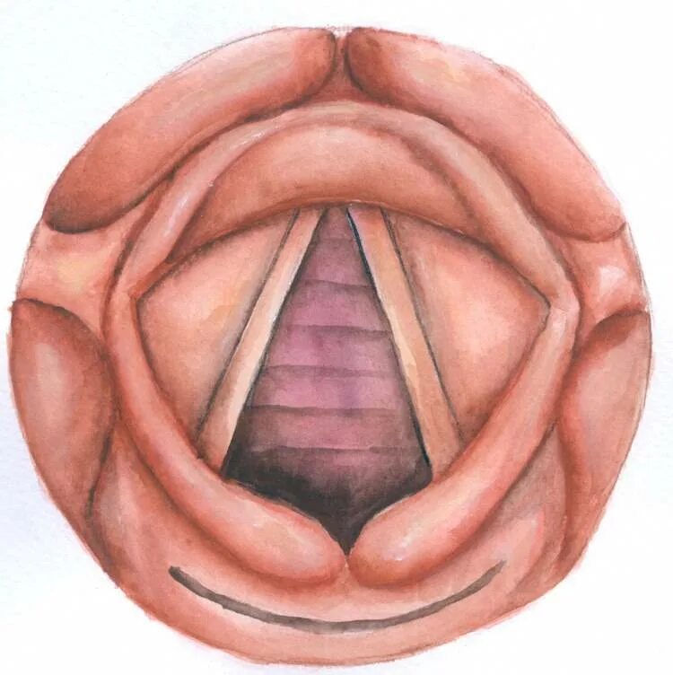 смещение гортани