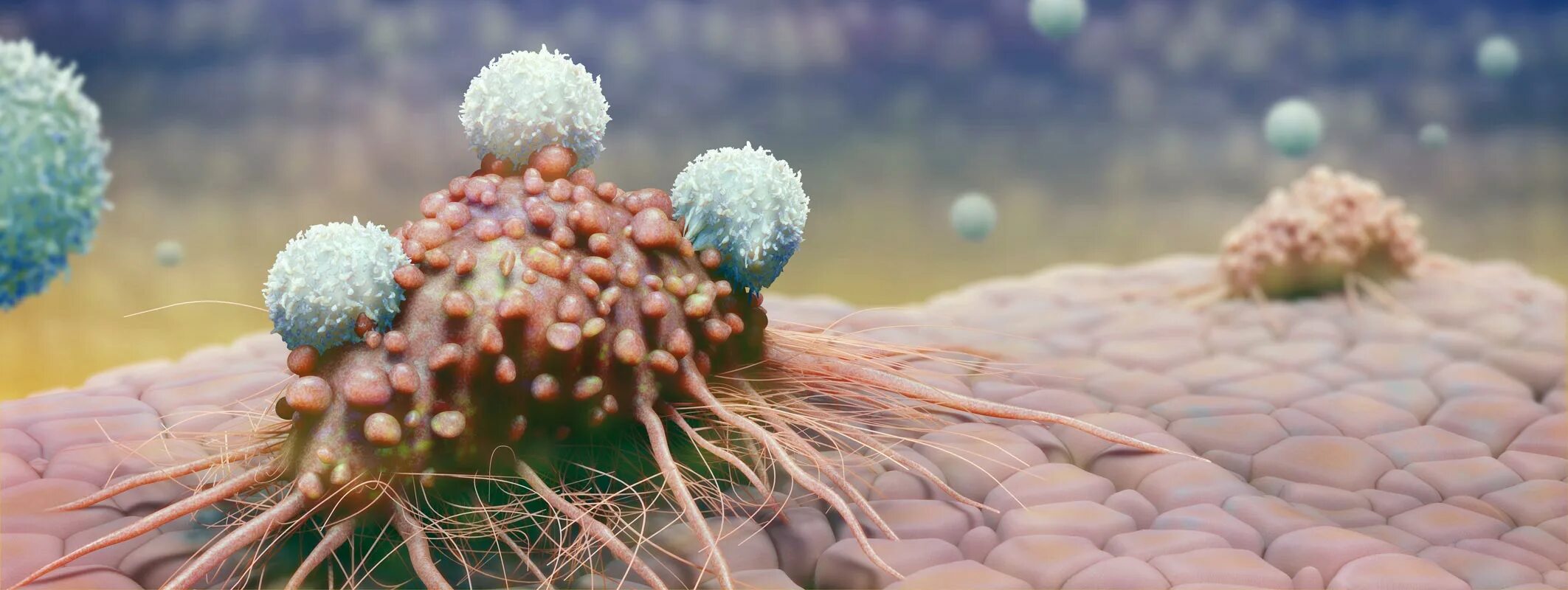 Нормальная клетка и раковая. Злокачественные образования. Иммунные и раковые клетки под микроскопом. Питание раковой клетки