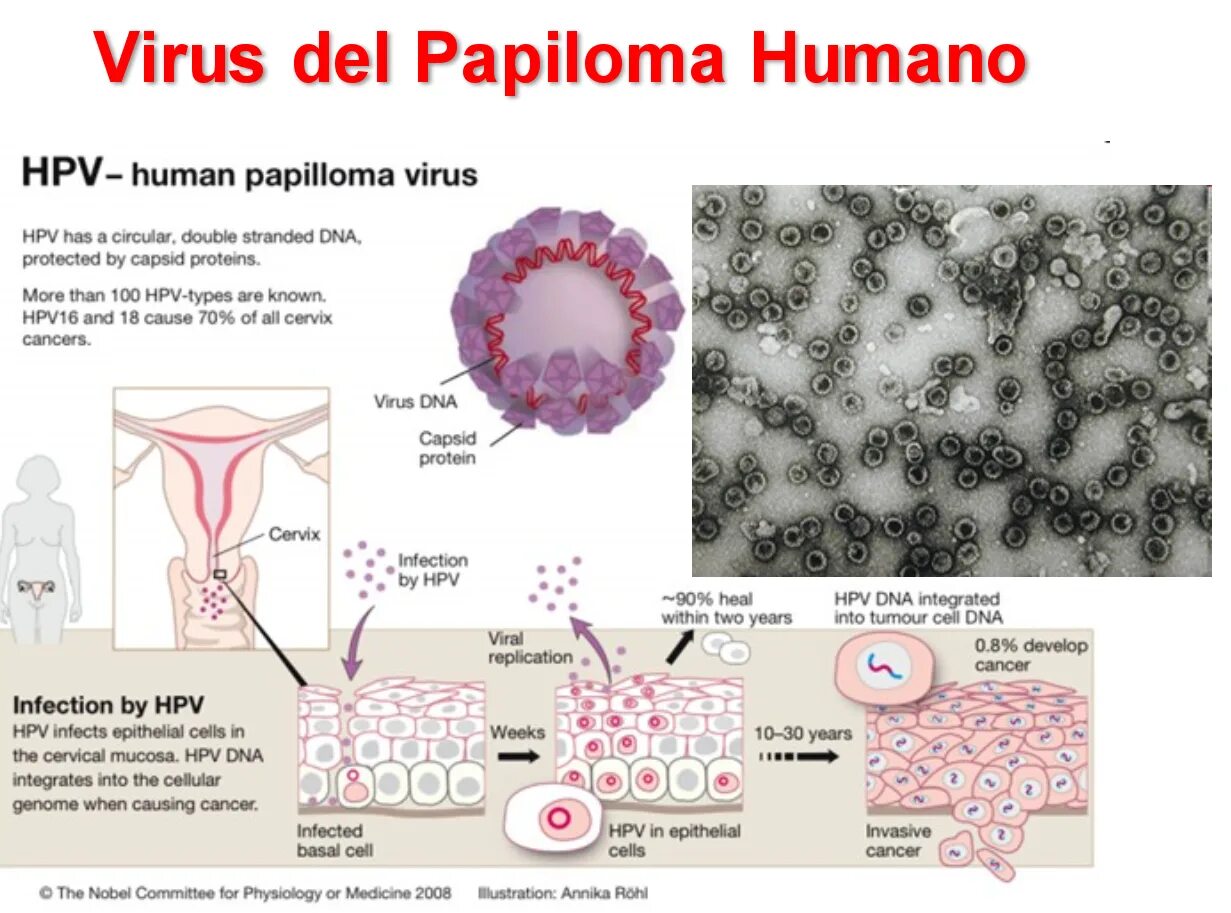 Вирус human. Вирус ВПЧ под микроскопом. Папилломавирус ВПЧ под микроскопом.
