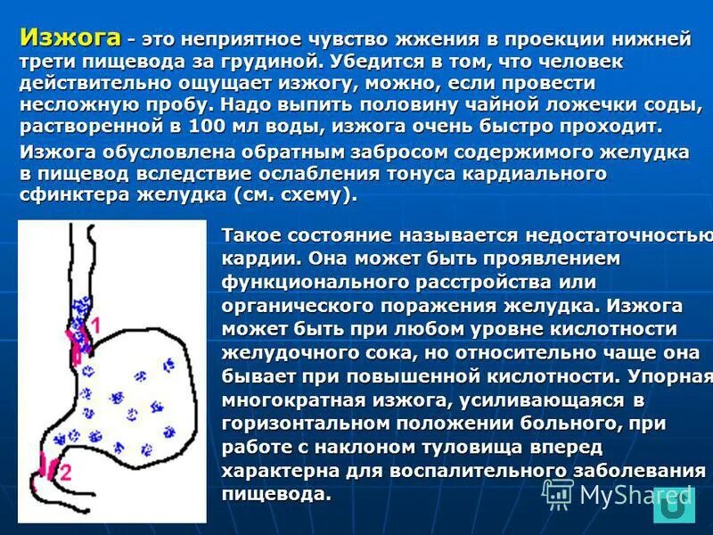 Кислотность желудка симптомы. Симптомы гастрита с пониженной кислотностью желудка. Кислотность желудка кошки. Может ли при пониженной кислотности быть изжога. Народное средство для повышенной кислотности желудка.