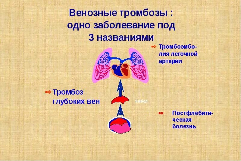 Венозная тромбоэмболия. СОП по профилактике венозных тромбозов и тромбоэмболий. Церебральный венозный тромбоз. Профилактика послеоперационных тромбозов