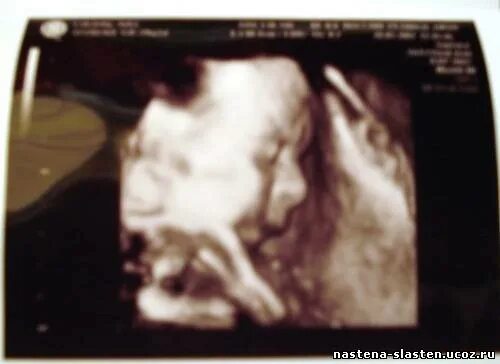 узи 3 недели беременности заключение. узи на 29 неделе беременности. узи на 29 неделе беременности. узи на 29 неделе беременности. узи ребенка на 29 неделе беременности.