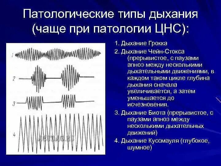 Формы патологических состояний