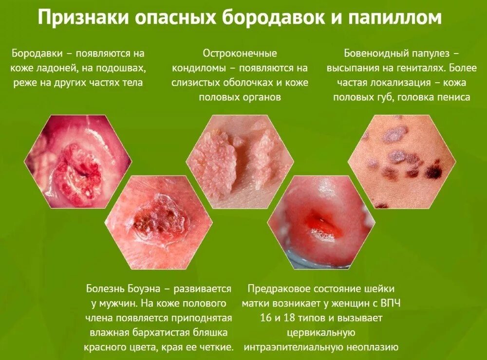 Можно ли заразиться через слизистую