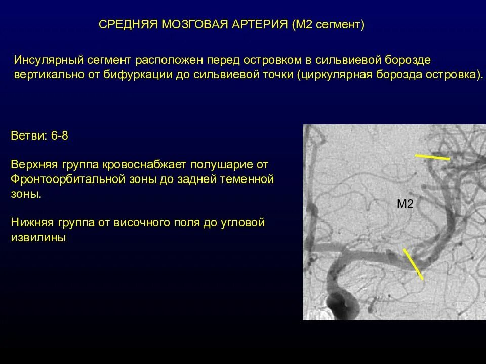 Артерии среднего мозга