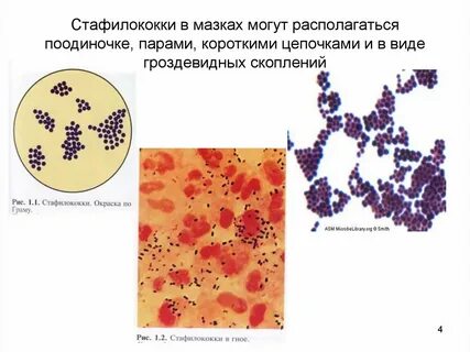В мазке стрептококки располагаются в виде