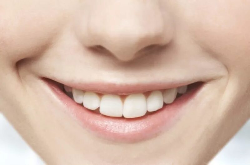Исследование улыбки. Сонник выпадение зубов без