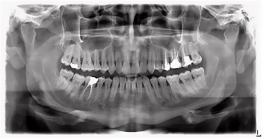 Панорамная рентгенография трубопроводов. Панорамный снимок зубов в Кстово. Панорамный снимок зубов в Лиде Экватор. Панорамный снимок Мытищи.