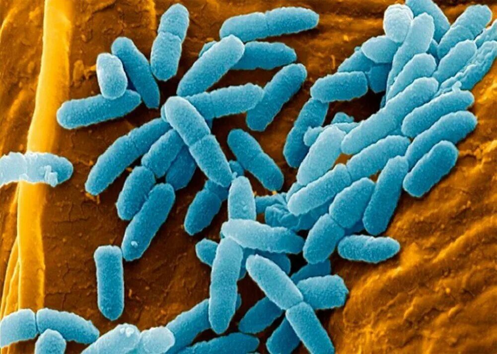 Псевдомонада aeruginosa. Бактерия Pseudomonas aeruginosa. Синегнойная палочка Псевдомония. Бактерия синегнойная палочка. Гнойная бактерия