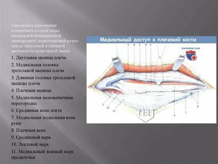 Разрез между