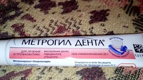 Воспаления дента