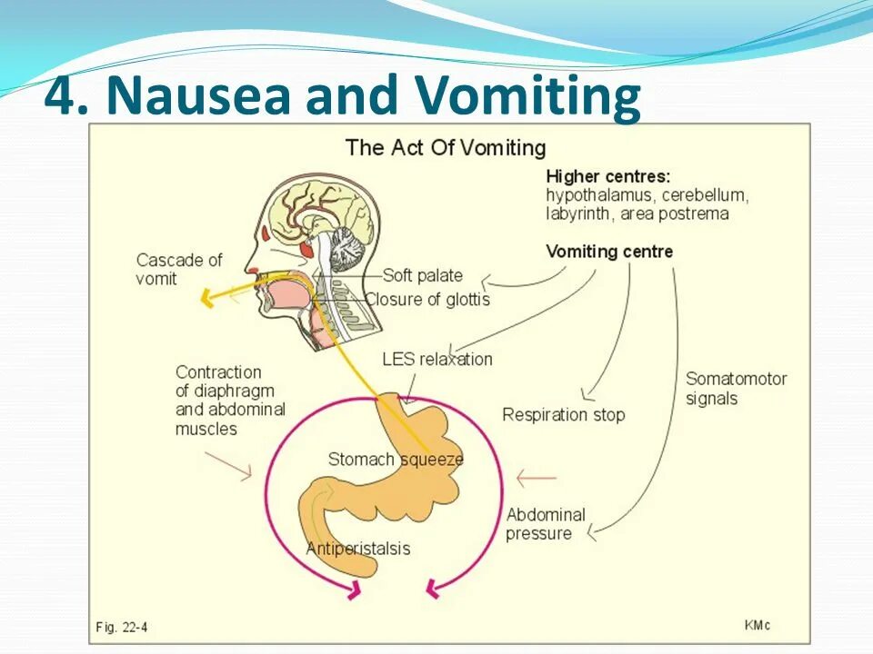Рвотный рефлекс рвота. Схема рвотного рефлекса. Схема возникновения рвоты. Центр рвотного рефлекса. Механизм рвоты.