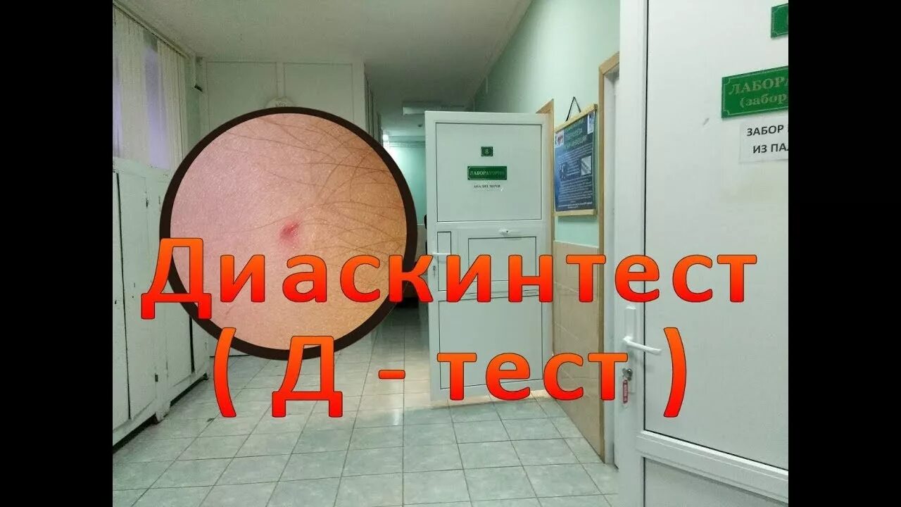 Результаты д тестов. Тест тест на туберкулез. Положительный диаскинтест фото.