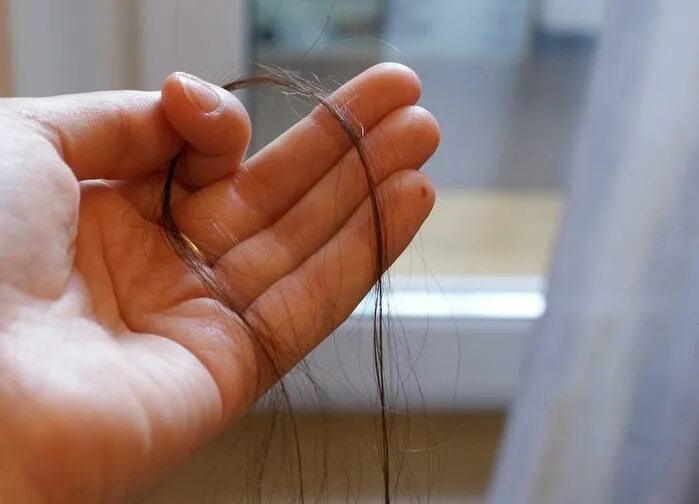 Норма выпадения волос. Норма выпадения волос в день. Выпадают волосы при мытье. Выпадение волос с луковицей.