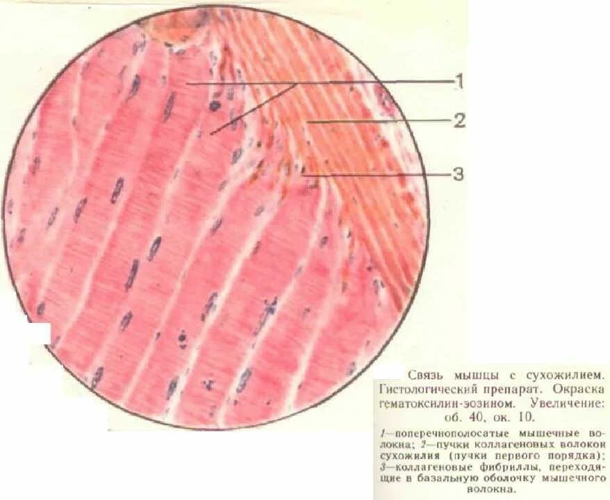 Поперечнополосатая мышца гистология. Поперечнополосатая Скелетная мышечная ткань гистология препарат. Поперечнополосатая мышечная ткань гистология. Мышечная ткань гистология препараты. Препарат поперечно полосатая мышечная ткань