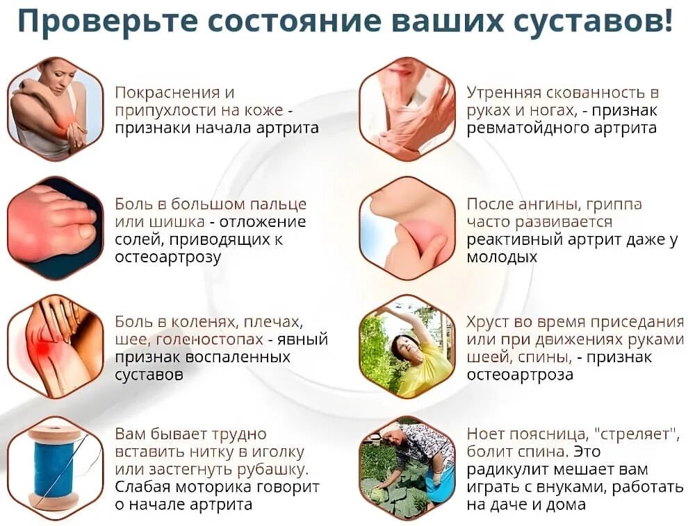 Можно ли есть помидоры при артрозе суставов. Профилактика при артрите. ревматоидный артрит памятка пациенту. памятка по профилактике заболеваний суставов.