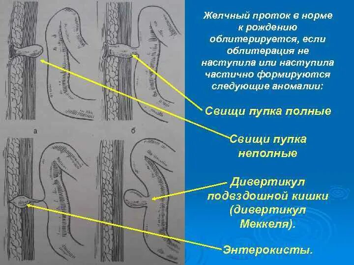 Код свища