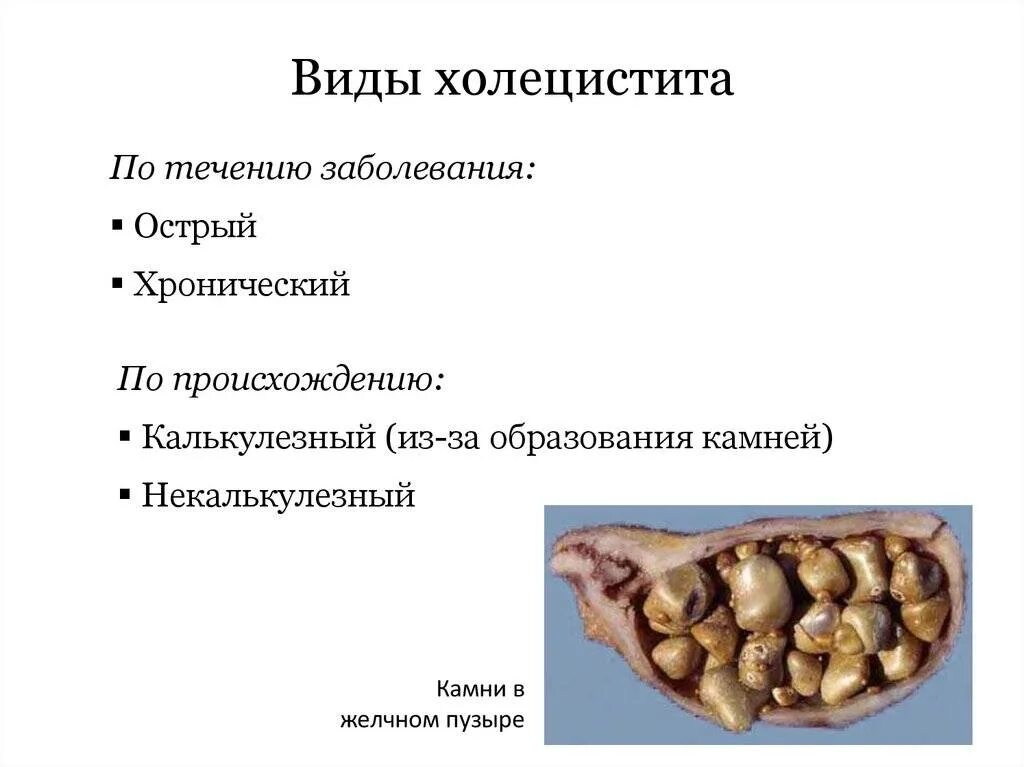 Хронические заболевания холецистит. Хронический калькулезный холецистит синдромы. Калькулезный холецистит и некалькулезный холецистит. Причины хронического калькулезного холецистита. Калькулезный холецистит острый и хронический.