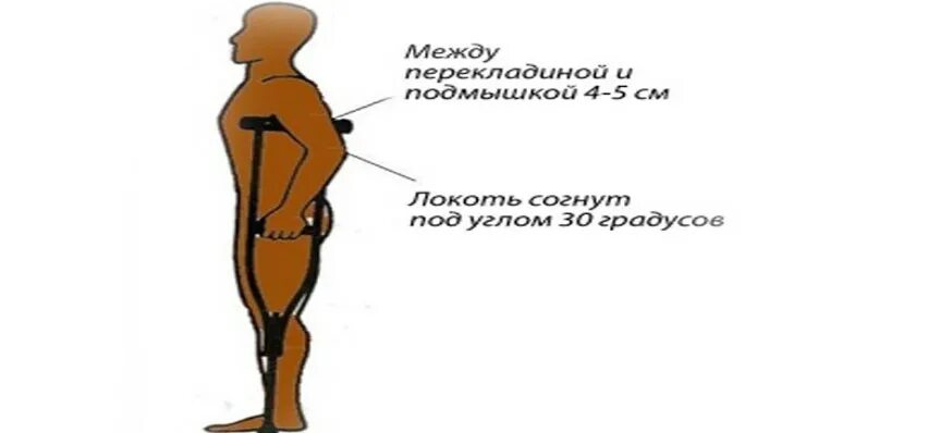 Как правильно отрегулировать костыли по росту. Как подобрать костыли. костыли подобрать под рост. правильная высота костылей. как правильно подобрать костыли подмышечные по росту.