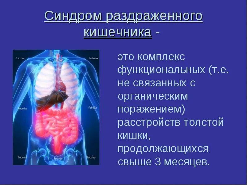 Боли кишечника симптомы и лечение у женщин. Синдром радраженногокишечника. Синдром раздраженного кишечника. Синдром раздражонова кешечни. Синдром раздраженной кишки.