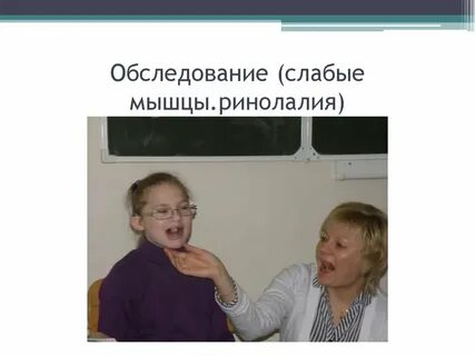 Ринолалия голос