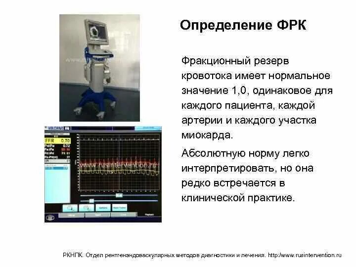 Кровоток не определяется. Кровоток не определяется