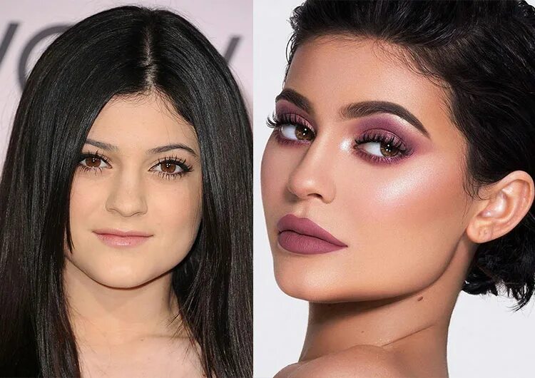 Форма глаз изменилась. Увеличение разреза глаза. Глаз в разрезе. Разная внешность. Изменение формы глаз.