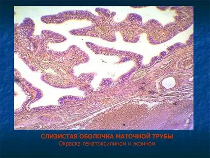 Гистология труб