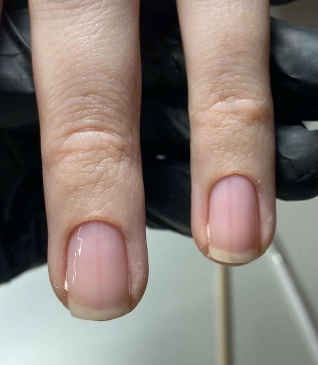 Лечение полос на ногтях. Лейконихия (белые пятнышки). Коричневые полоски на ногтях. Поперечные полосы на ногтях. Коричневые полоски под ногтями.