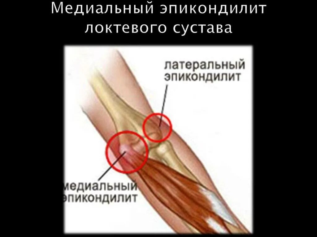Боли колене разгибании лечение