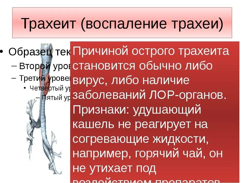 Трахеит острый симптомы болезни.