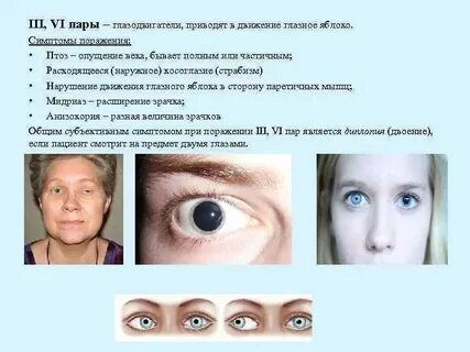 Неврология глаз