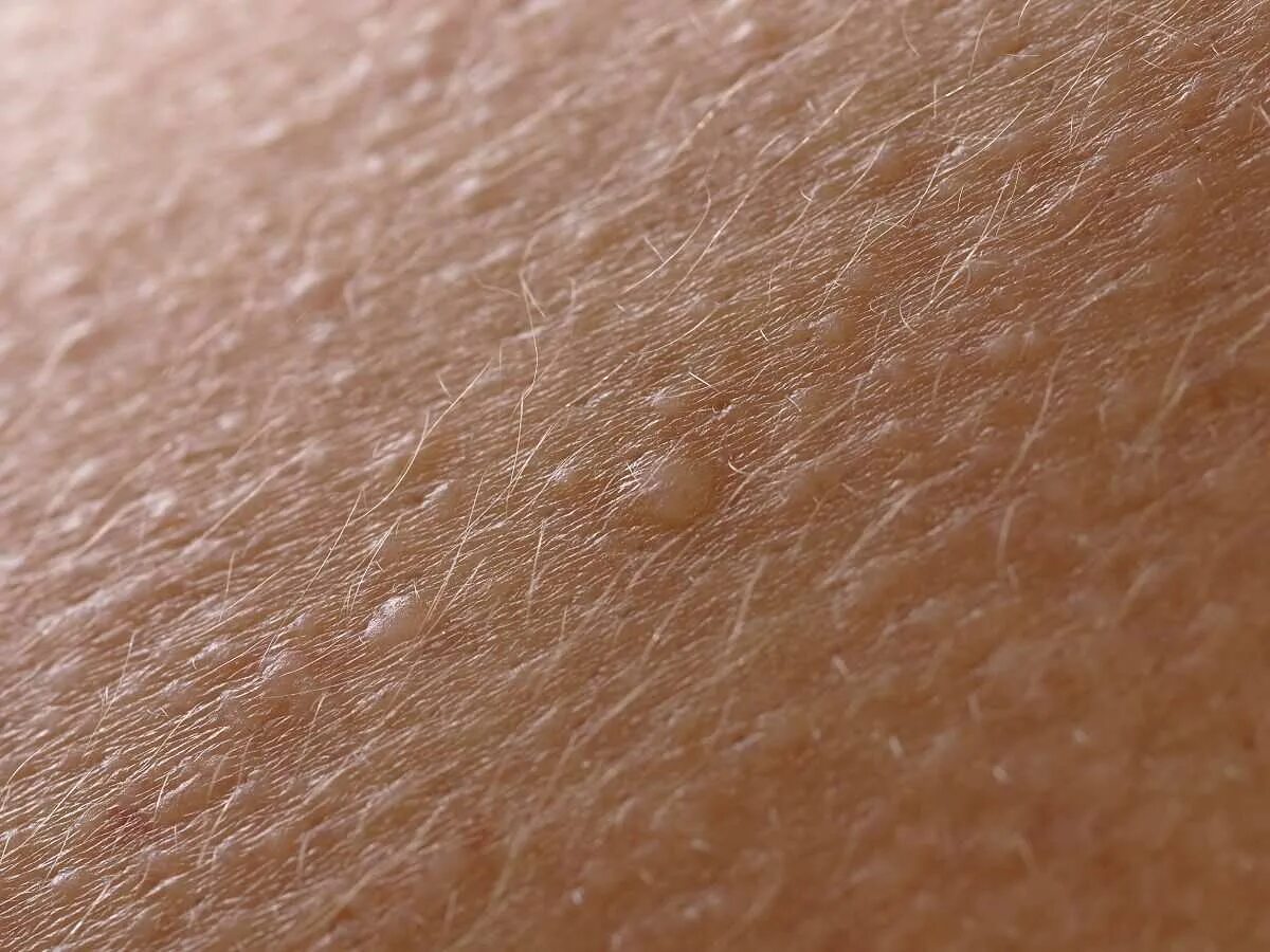 Плотный заметить. Плотный заметить