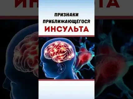 Приближающийся инсульт