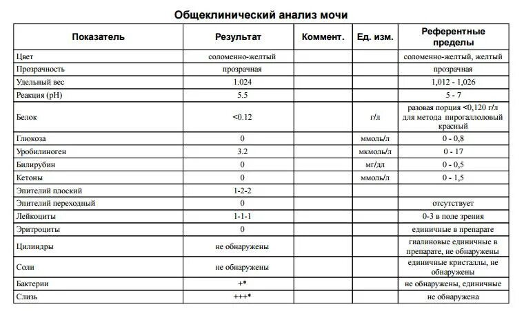 Общий анализ мочи норма таблица. Анализ мочи нормальные показатели - таблица. Общий анализ мочи норма и расшифровка результатов таблица у женщин. Норма анализов мочи у женщины таблица общий.