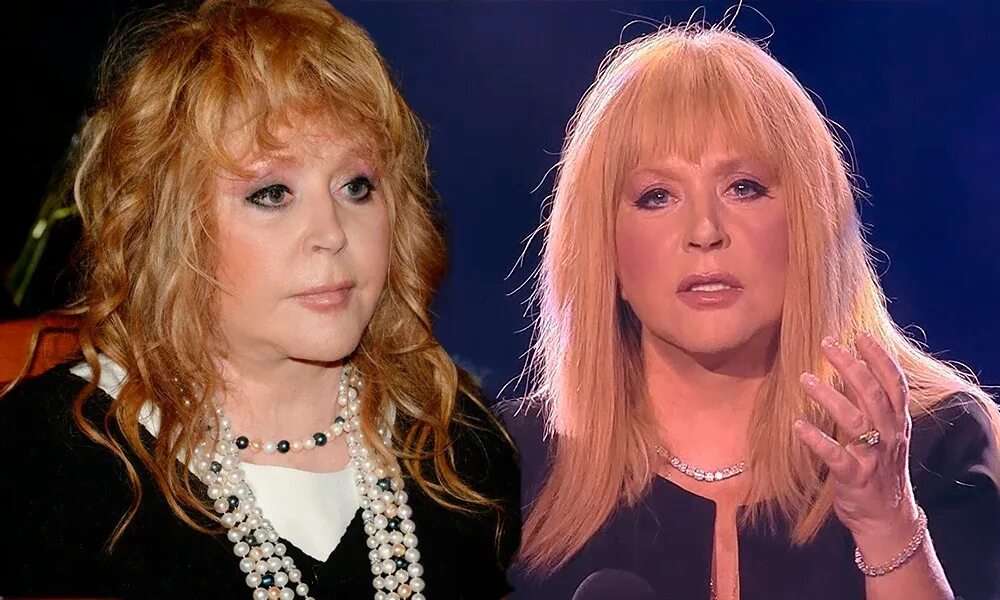 Пугачева худая. Пластические операции аллы пугачевой. Пугачева сейчас. Пугачева после. Пугачева 1992.