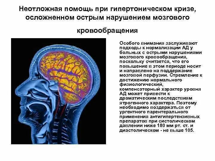 Недостаточности кровоснабжения мозга. Острое нарушение мозгового кровообращения. Неотложная помощь при осложненном гипертоническом кризе. Преходящее нарушение мозгового кровообращения. Мозг нарушение микроциркуляции.